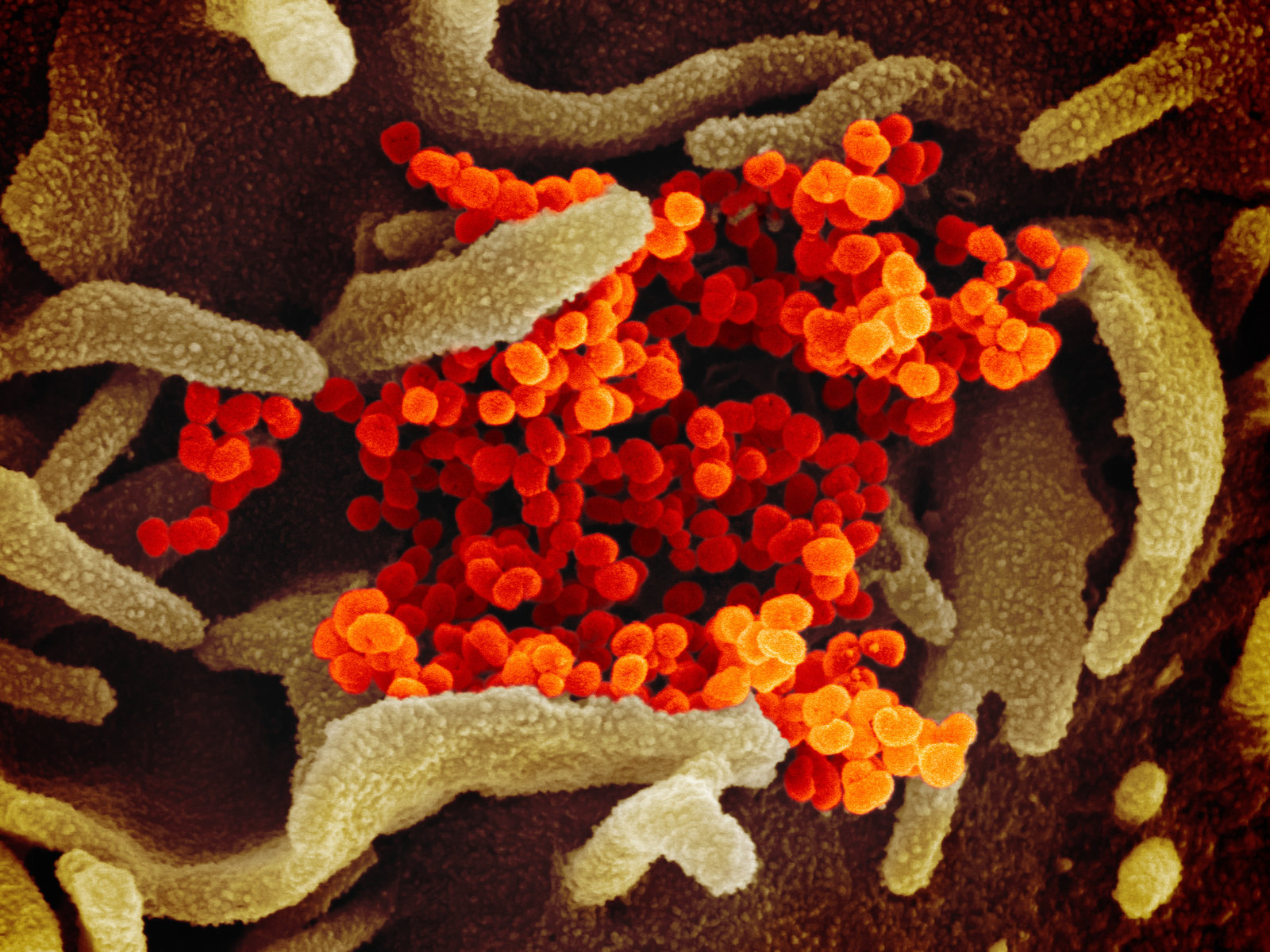 In this image from a scanning electron microscope, the new coronavirus is in orange.