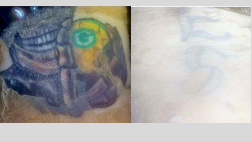 tattoos